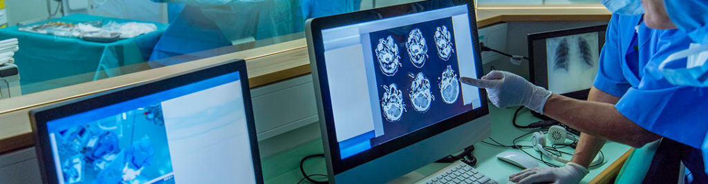 Healthcare professionals in a hospital review brain scan images on a computer monitor. They wear surgical masks and gloves, and other medical images are visible on additional screens. A surgery appears to be taking place in the background.